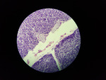 MISSING THUMBNAIL